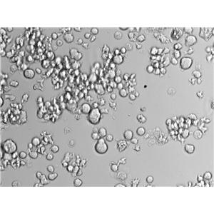 OCI-Ly1 Cell Lines:人弥漫大B淋巴瘤细胞(STR认证)