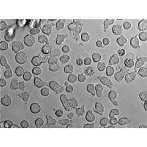 OCI-Ly19 Cell Lines:人弥漫大B淋巴瘤细胞(STR认证)