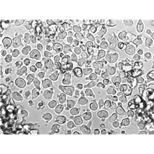 HDLM-2 Cell Lines:人霍奇金淋巴瘤细胞(STR认证)