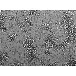 L-428 Cell Lines:人霍奇金淋巴瘤细胞(STR认证),L-428 Cell Lines