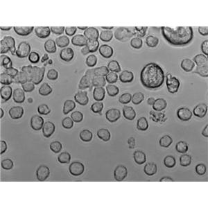 KM-H2 Cell Lines:人霍奇金淋巴瘤细胞(STR认证)