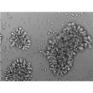 KHYG-1 Cell Lines:人NK细胞淋巴瘤细胞(STR认证)