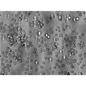 Kit225 Cell Lines:人T淋巴细胞(STR认证),Kit225 Cell Lines