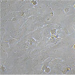 BIU-87 Cell|人膀胱癌细胞