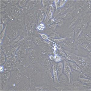 QBC939 Cell|人胆管癌细胞,QBC939 Cell