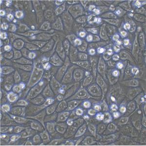 NCI-H157 Cell|人非小细胞肺腺癌细胞