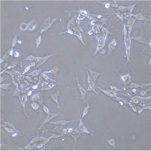 5-8F Cell|鼻咽癌细胞