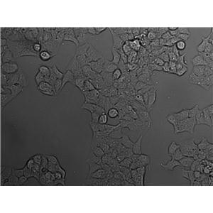 PC-3M Cell|人前列腺癌细胞