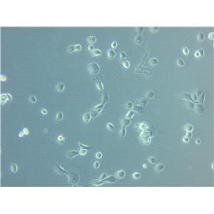 COLO 320DM Cell|人结直肠腺癌细胞
