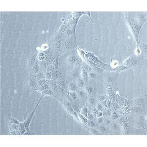 COLO 201 Cell|人结直肠腺癌细胞