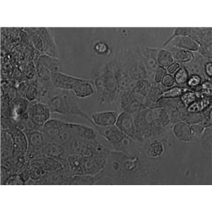 ZR-75-30 Cell|人乳腺癌细胞