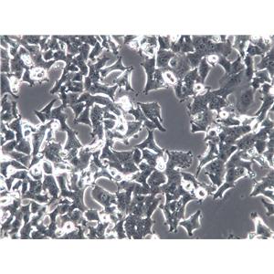 U2OS Cell|人骨肉瘤细胞