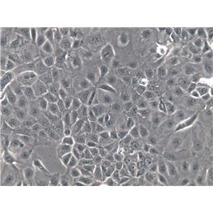RKO-AS45-1 Cell|人结肠癌转基因细胞