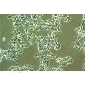 FO [Mouse myeloma] Cell|小鼠骨髓瘤细胞,FO [Mouse myeloma] Cell