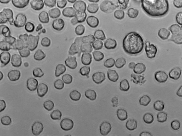 MOLT-4|人急性淋巴母细胞性白血病血清培养细胞(免费送STR),MOLT-4