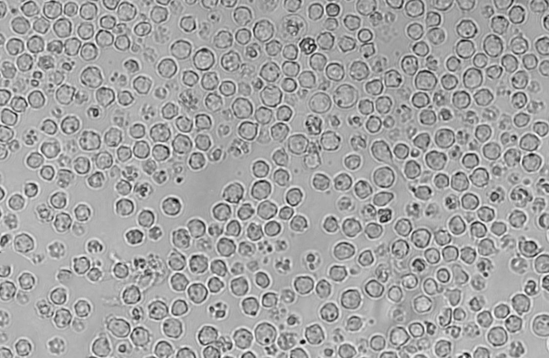 NCI-H929|人浆细胞白血病血清培养细胞(免费送STR),NCI-H929