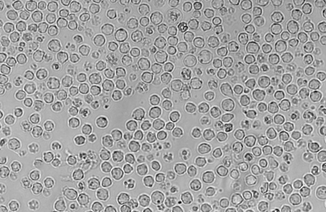 U266B1|人外周淋巴血清培养细胞(免费送STR),U266B1