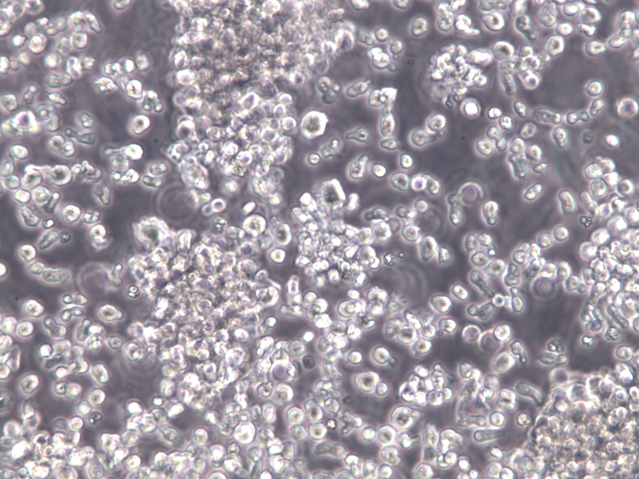 NK-92|人恶性非霍奇金淋巴瘤患者NK血清培养细胞(免费送STR),NK-92