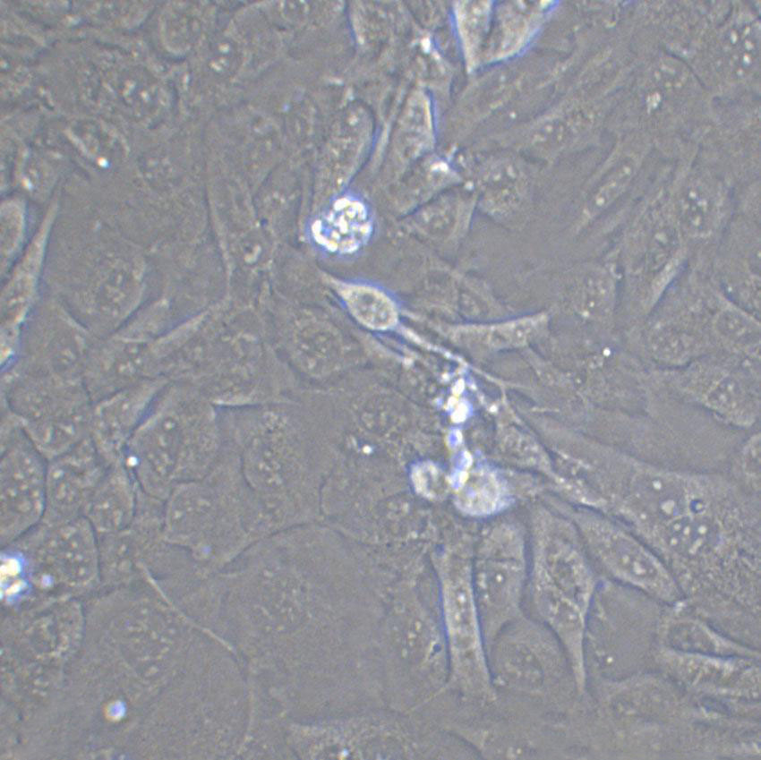 KTC-1 Cell|人甲状腺癌细胞,KTC-1 Cell