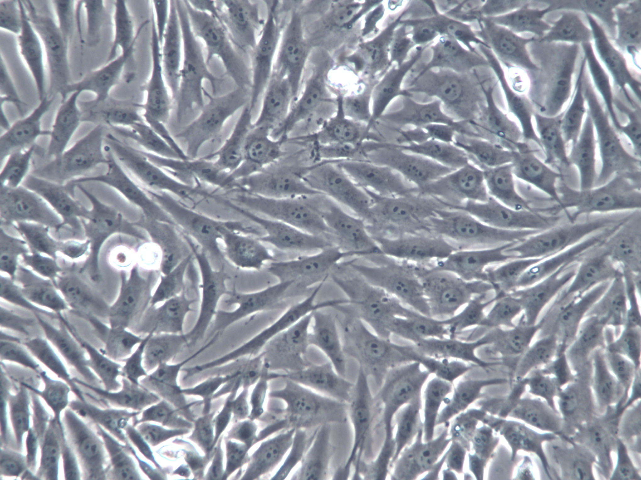 MEC-1 Cell|人粘液表皮样癌细胞,MEC-1 Cell
