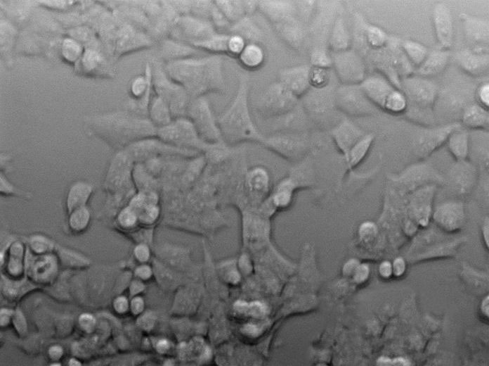 PaTu 8988s Cell|人胰腺癌细胞,PaTu 8988s Cell