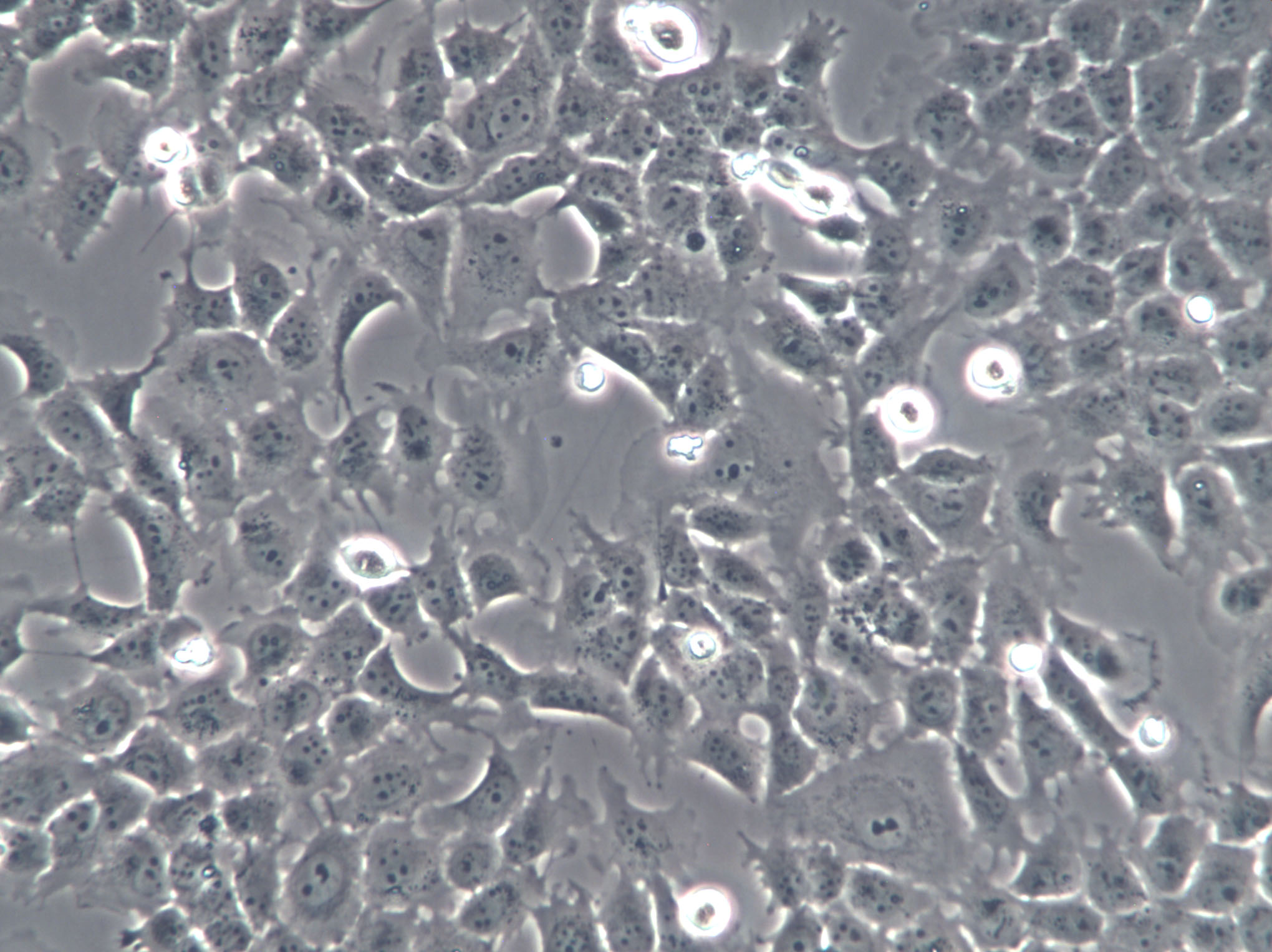 CHL-1 Cell:人黑色素瘤细胞系价格 厂家：上海宾穗生物科技有限公司