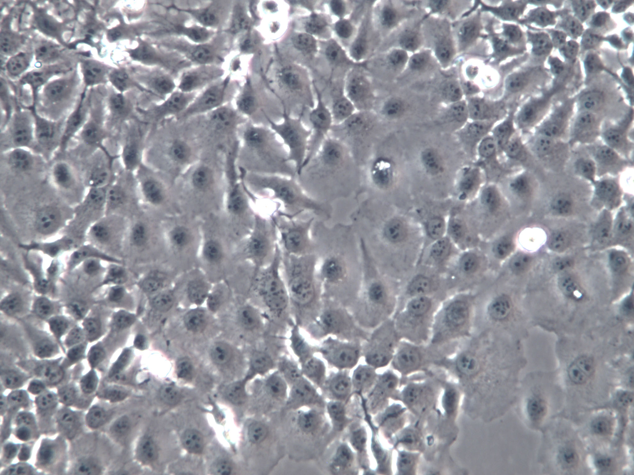 HUVEC-C[HUVEC] Cell|人脐静脉血管内皮细胞,HUVEC-C[HUVEC] Cell
