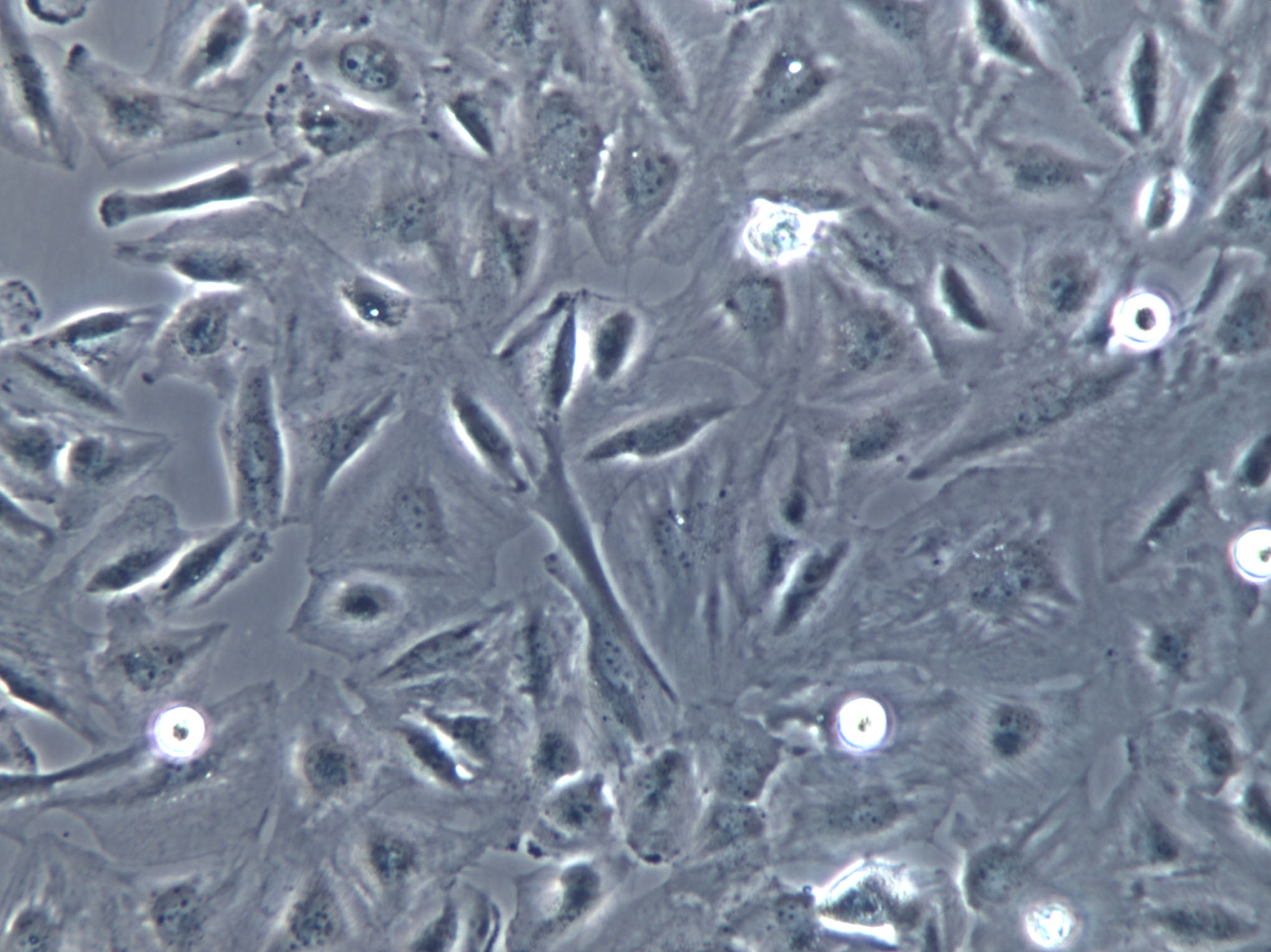 KMS-11 Cell|人多发性骨髓瘤细胞KMS-11 Cell|人多发性骨髓瘤细胞,KMS-11 Cell