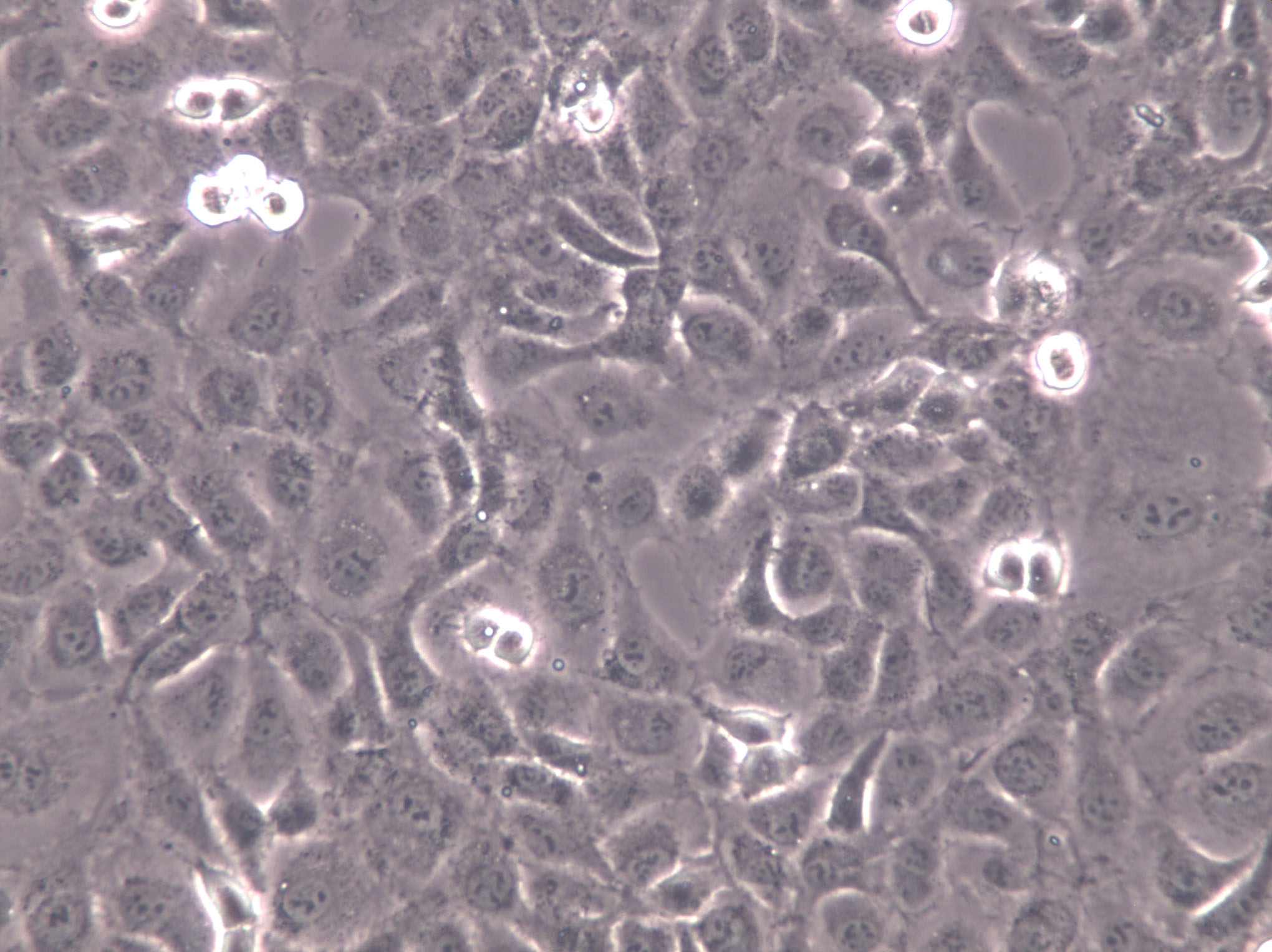 KMM-1 Cell|人多发性骨髓瘤细胞,KMM-1 Cell