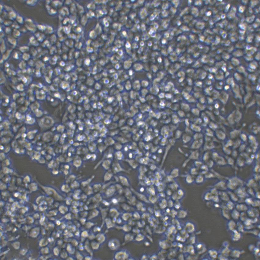 A2780/CP70 Cell|人卵巢癌细胞,A2780/CP70 Cell