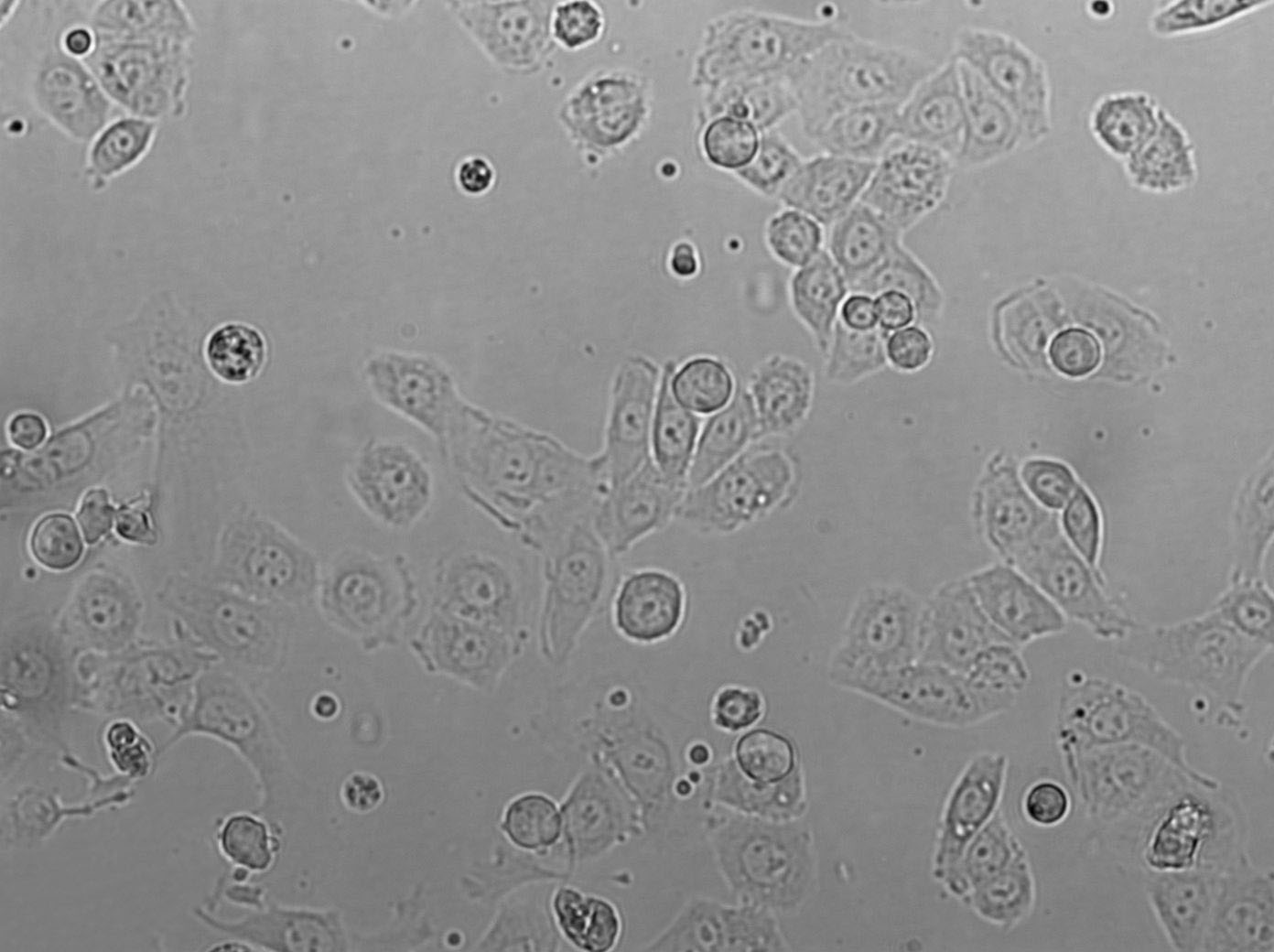 NP69SV40T Cell|人鼻咽上皮细胞,NP69SV40T Cell