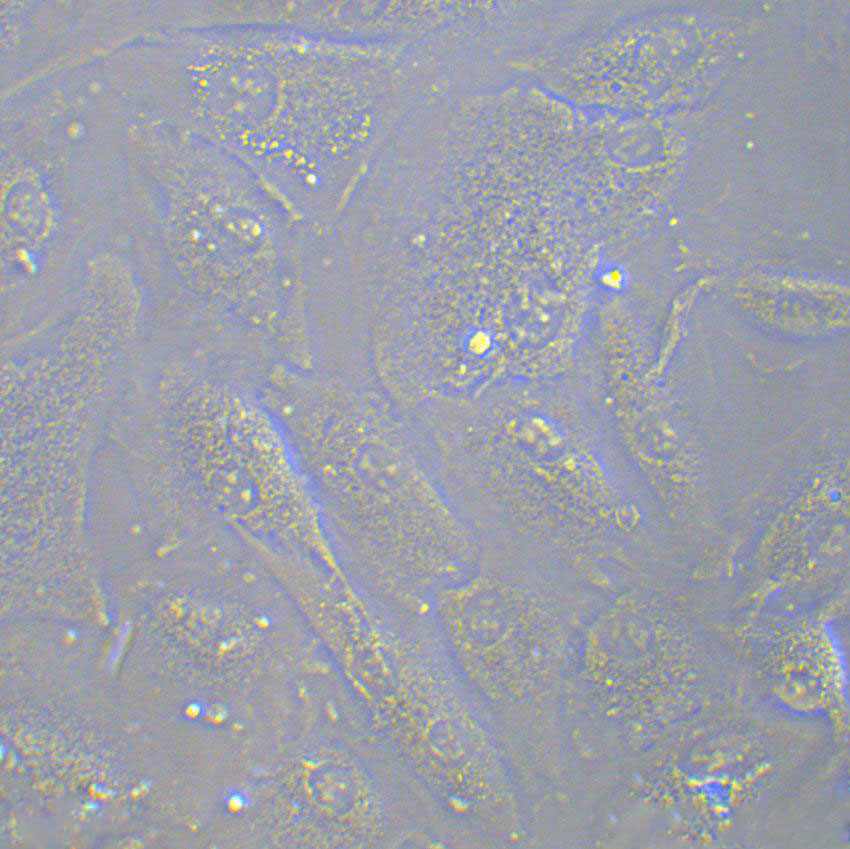 U-138MG Cell|人脑神经胶质瘤细胞,U-138MG Cell