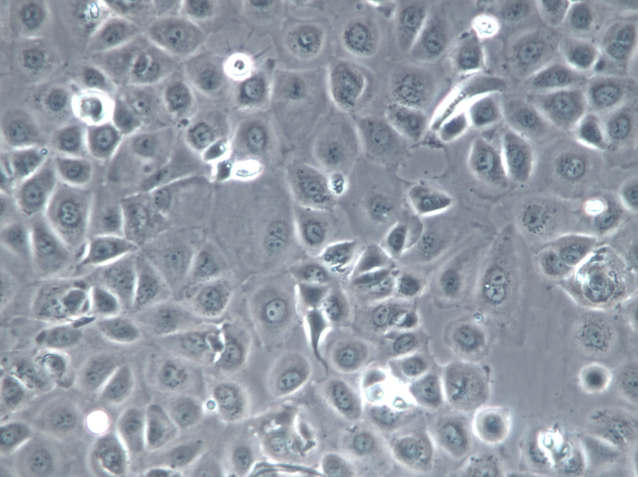 LA-N-1 Cell|人神经母细胞瘤细胞,LA-N-1 Cell