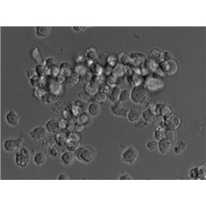 HEL|人红白细胞白血病血清培养细胞(免费送STR)