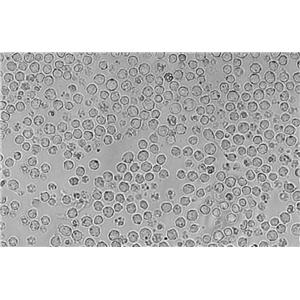 NCI-H929|人浆细胞白血病血清培养细胞(免费送STR)