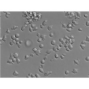 OCI-AML-3|人急性髓细胞性白血病血清培养细胞(免费送STR)