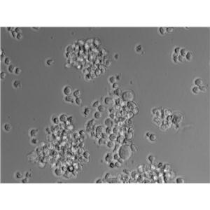 MDCC-MSB1|鸡淋巴瘤血清培养细胞(免费送STR)