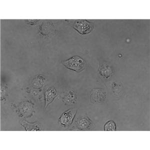 WSU-HN13 Cell|人口腔鳞状细胞癌细胞,WSU-HN13 Cell
