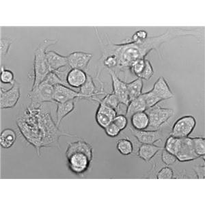 T-HEECs Cell|人正常食管上皮细胞,T-HEECs Cell