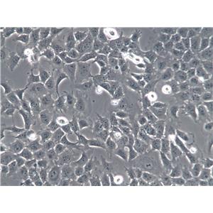 PIG1 Cell|正常人皮肤黑色素细胞