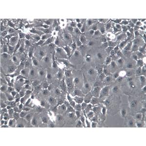 HUVEC-C[HUVEC] Cell|人脐静脉血管内皮细胞