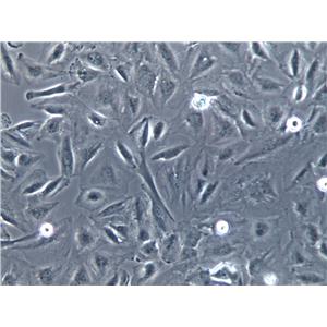 KMS-11 Cell|人多发性骨髓瘤细胞KMS-11 Cell|人多发性骨髓瘤细胞