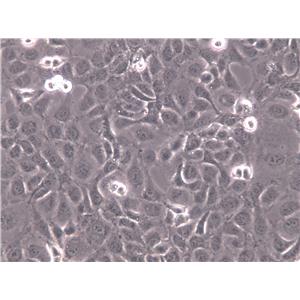 KMM-1 Cell|人多发性骨髓瘤细胞,KMM-1 Cell