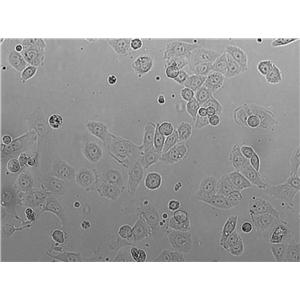 NP69SV40T Cell|人鼻咽上皮细胞