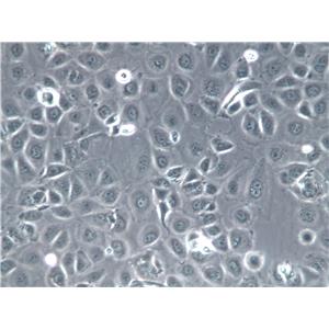 LA-N-1 Cell|人神经母细胞瘤细胞