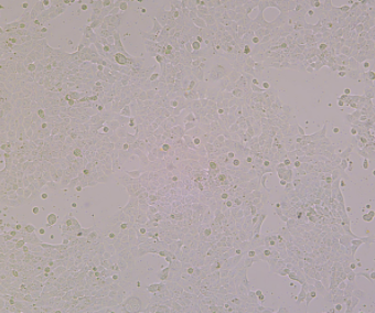 4T1（小鼠乳腺癌细胞）,4T1