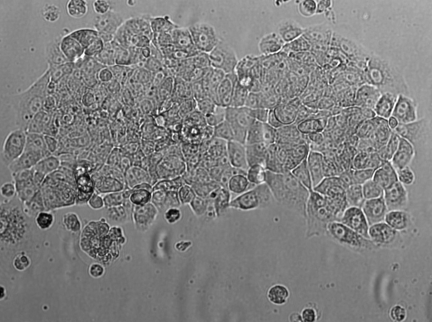 Evsa-T Cell|人乳腺癌细胞,Evsa-T Cell