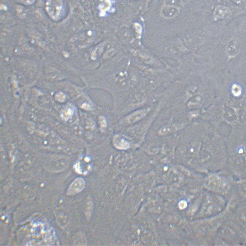 SUM149PT Cell|人乳腺癌细胞,SUM149PT Cell