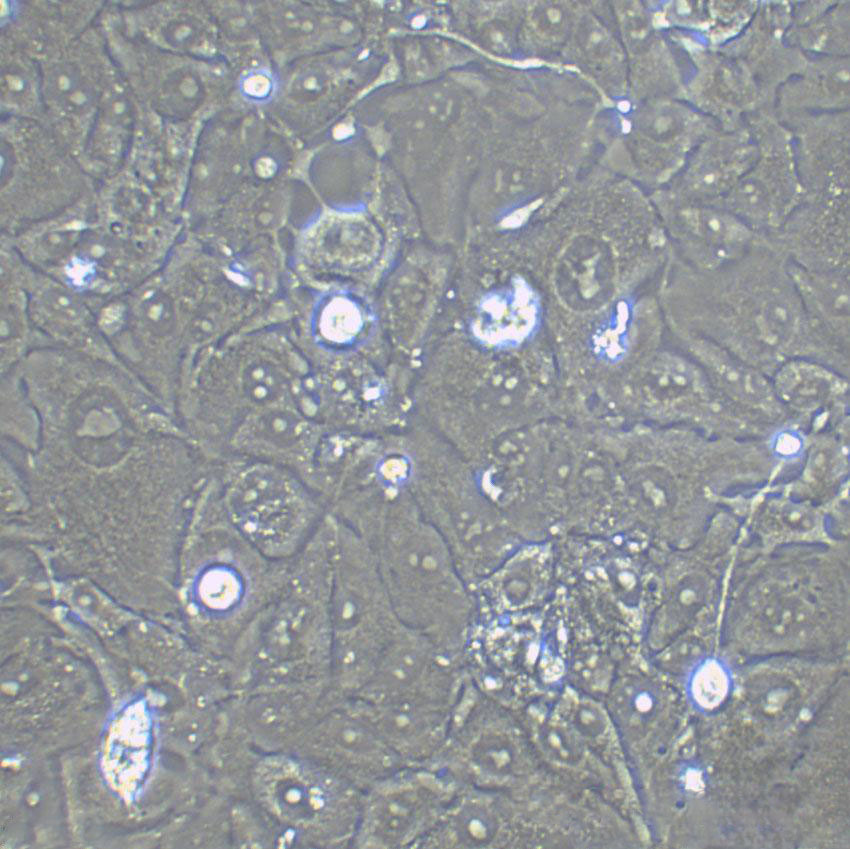 NCI-H1417 Cell|人小细胞肺癌细胞,NCI-H1417 Cell
