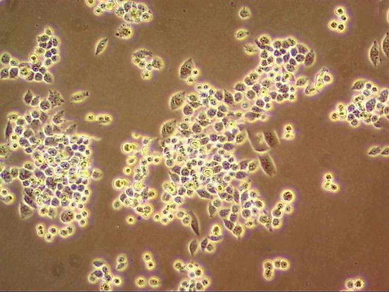 MUTZ-1 Cell|人骨髓增生异常综合征细胞,MUTZ-1 Cell